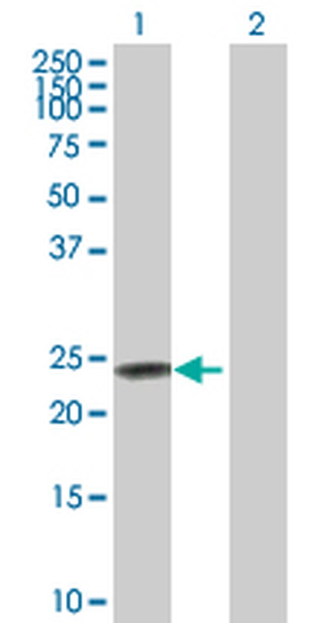 FXN Antibody in Western Blot (WB)