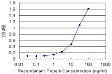 FTL Antibody in ELISA (ELISA)