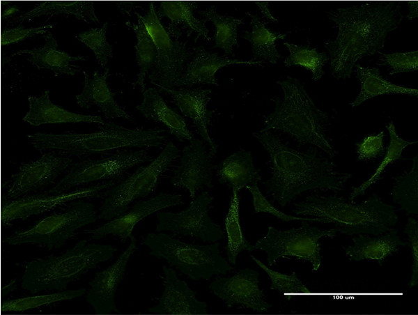 FTL Antibody in Immunocytochemistry (ICC/IF)