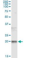 FTL Antibody in Immunoprecipitation (IP)