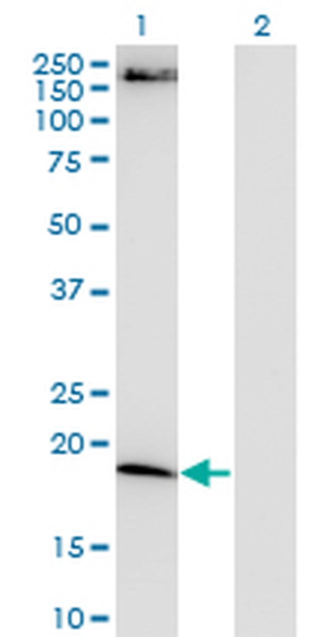 FTL Antibody in Western Blot (WB)