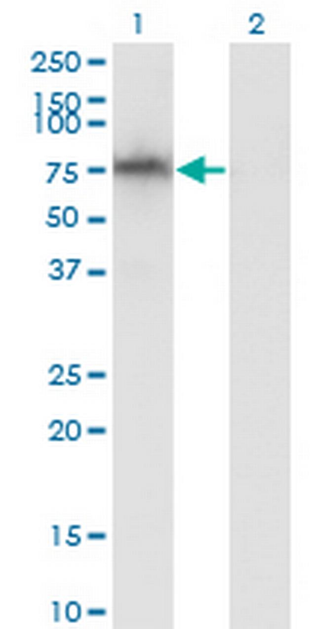 ADAM2 Antibody in Western Blot (WB)