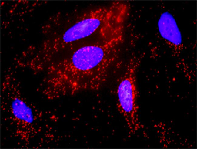 FYN Antibody in Proximity Ligation Assay (PLA) (PLA)