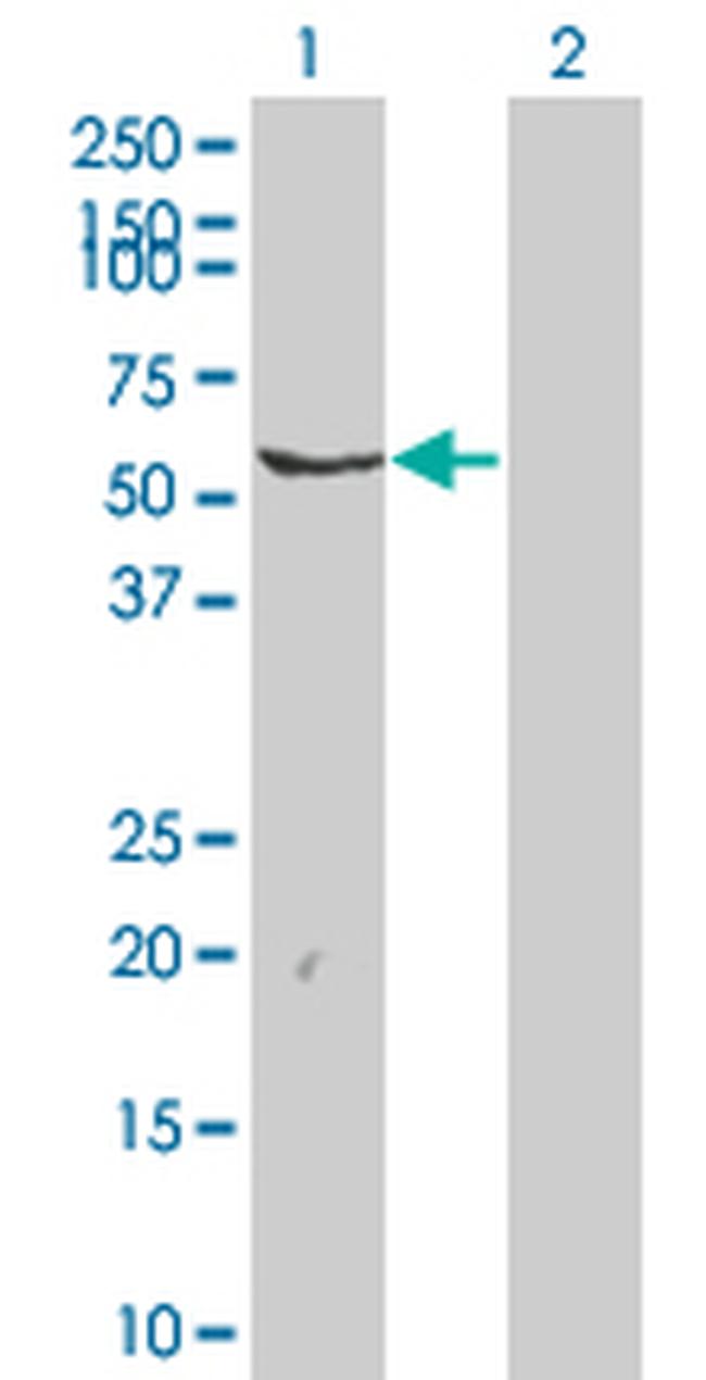 FYN Antibody in Western Blot (WB)