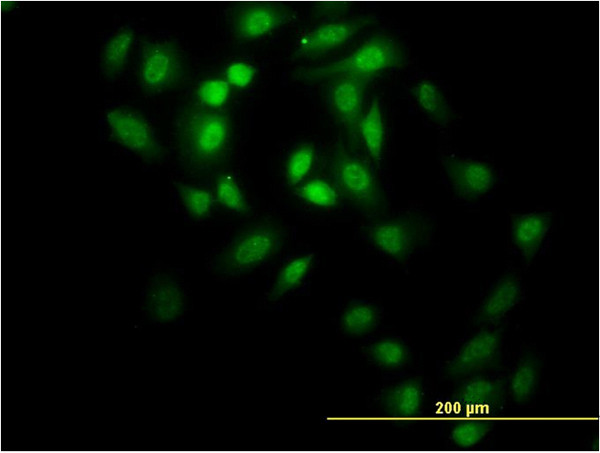 GABPA Antibody in Immunocytochemistry (ICC/IF)