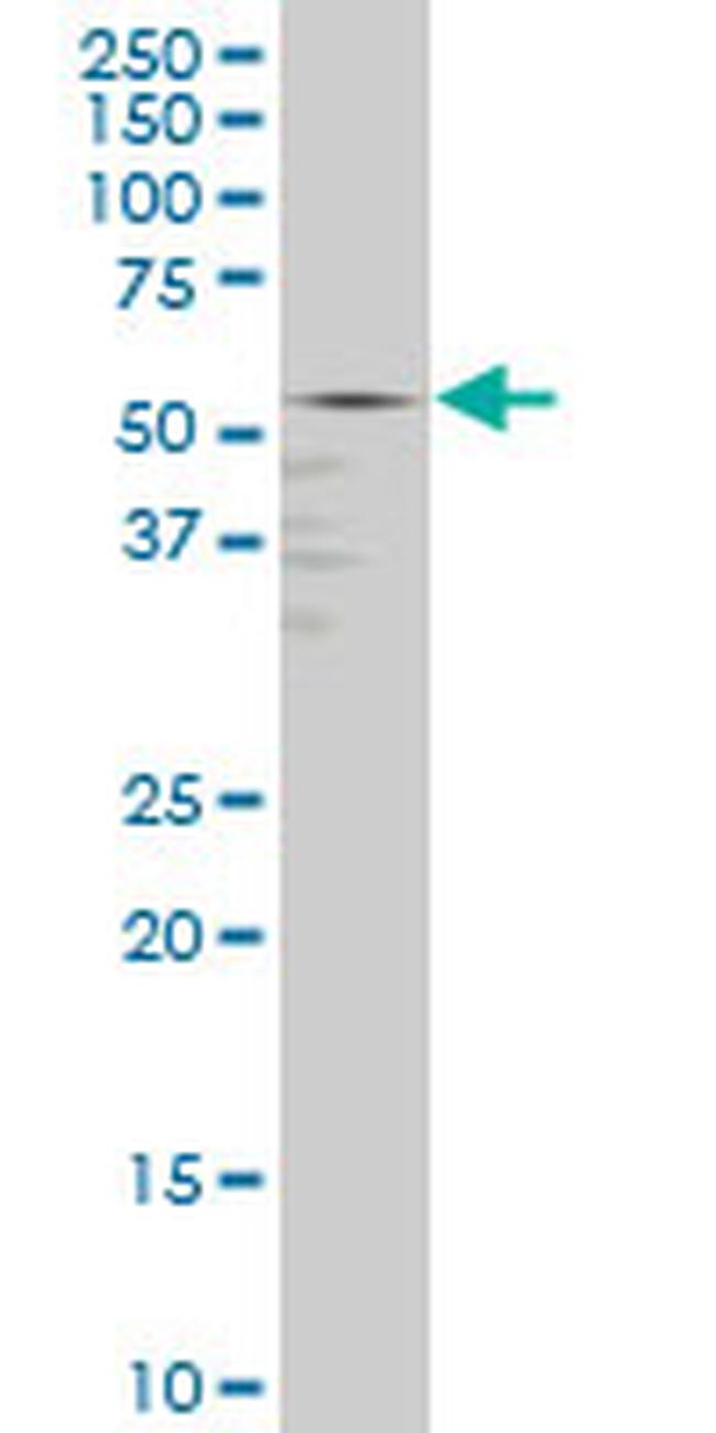 GABPA Antibody in Western Blot (WB)