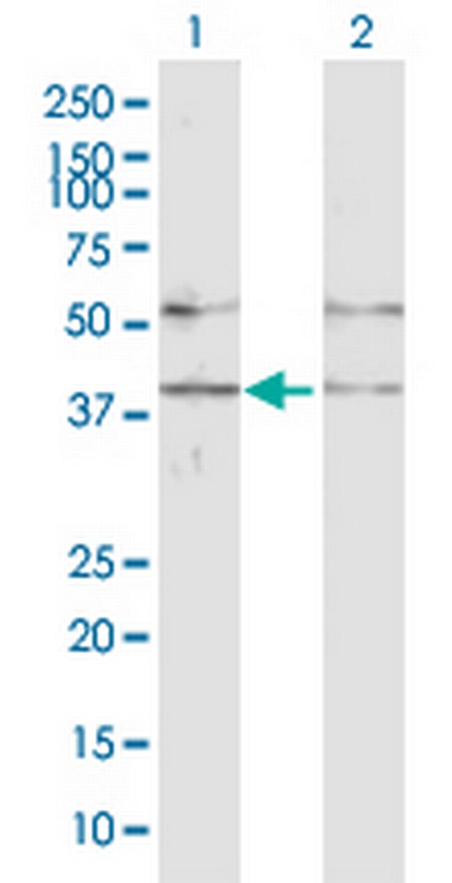 GABPB1 Antibody in Western Blot (WB)