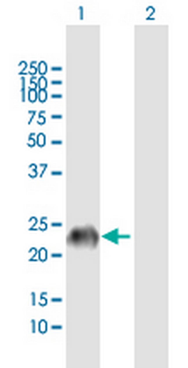 GAGE7 Antibody in Western Blot (WB)