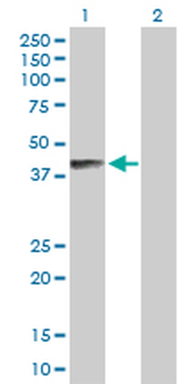 B4GALNT1 Antibody in Western Blot (WB)