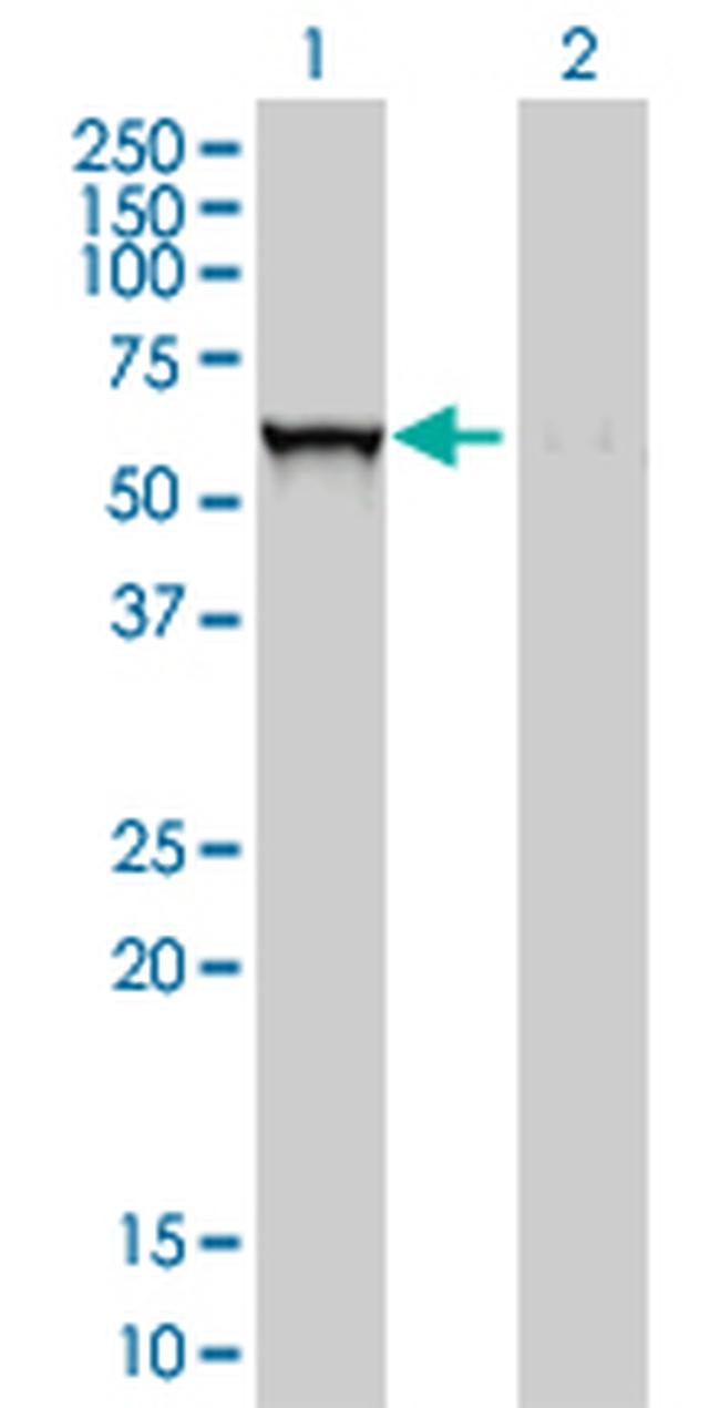 GBA Monoclonal Antibody (2E2) (H00002629-M01)