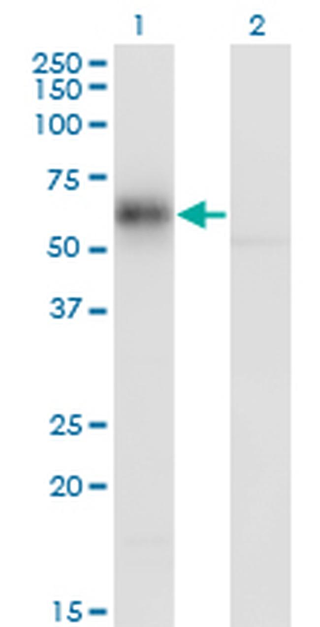 GDI1 Antibody in Western Blot (WB)