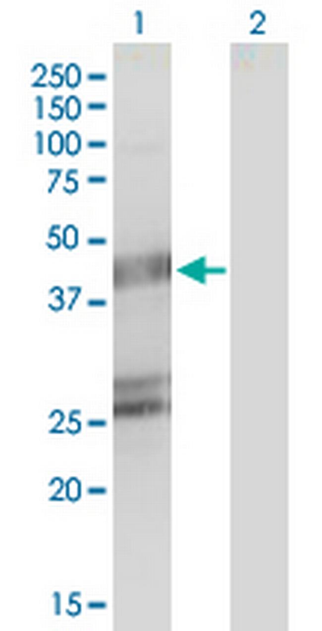 GFAP Antibody in Western Blot (WB)