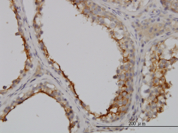 GGT1 Antibody in Immunohistochemistry (Paraffin) (IHC (P))