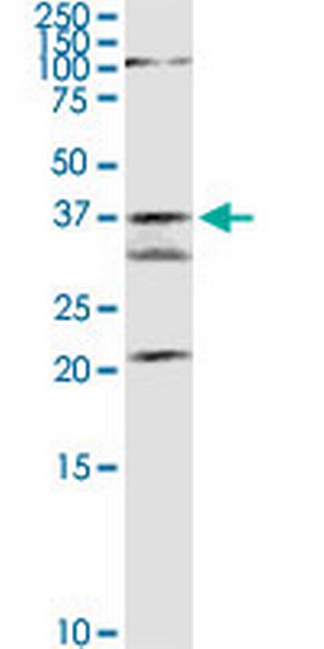 GMDS Antibody in Western Blot (WB)