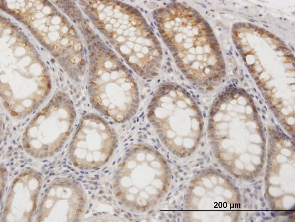 GOT1 Antibody in Immunohistochemistry (Paraffin) (IHC (P))