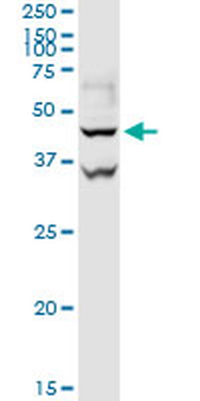 GOT1 Antibody in Western Blot (WB)