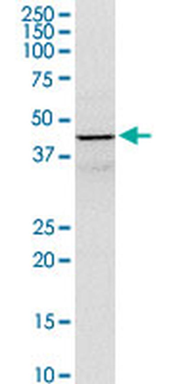 GOT1 Antibody in Western Blot (WB)