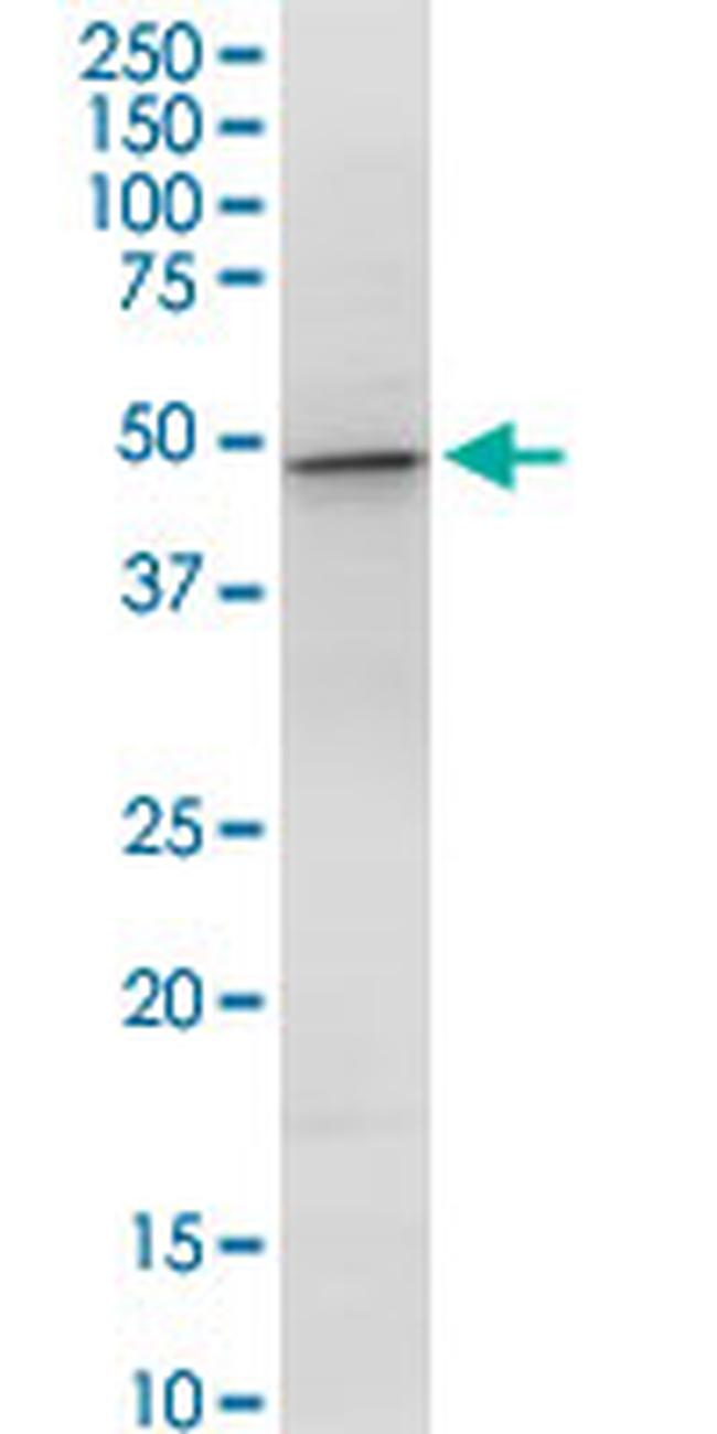 GOT1 Antibody in Western Blot (WB)