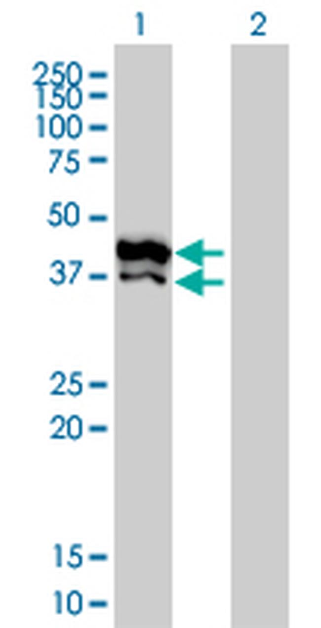 GPD2 Antibody in Western Blot (WB)