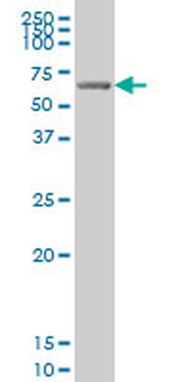 GRK6 Antibody in Western Blot (WB)