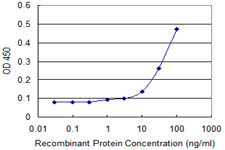 GPT Antibody in ELISA (ELISA)