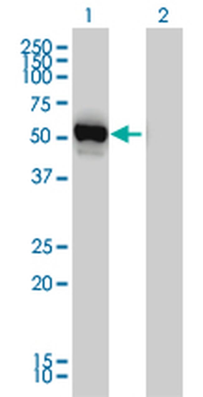 GPT Antibody in Western Blot (WB)