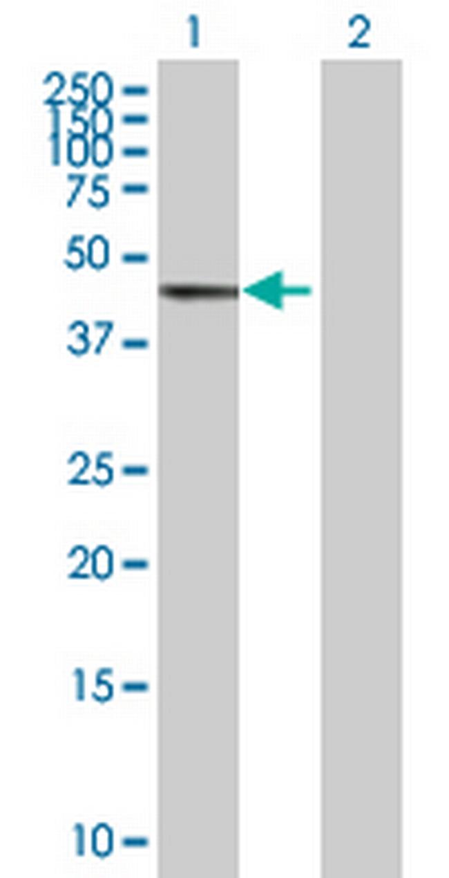 GTF2H4 Antibody in Western Blot (WB)