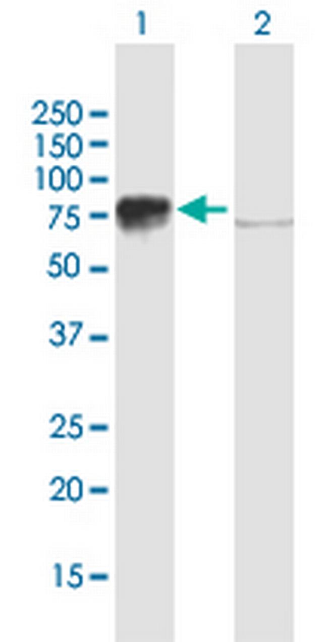 BRF1 Antibody in Western Blot (WB)