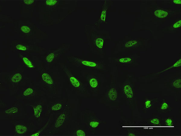 GTF3C2 Antibody in Immunocytochemistry (ICC/IF)