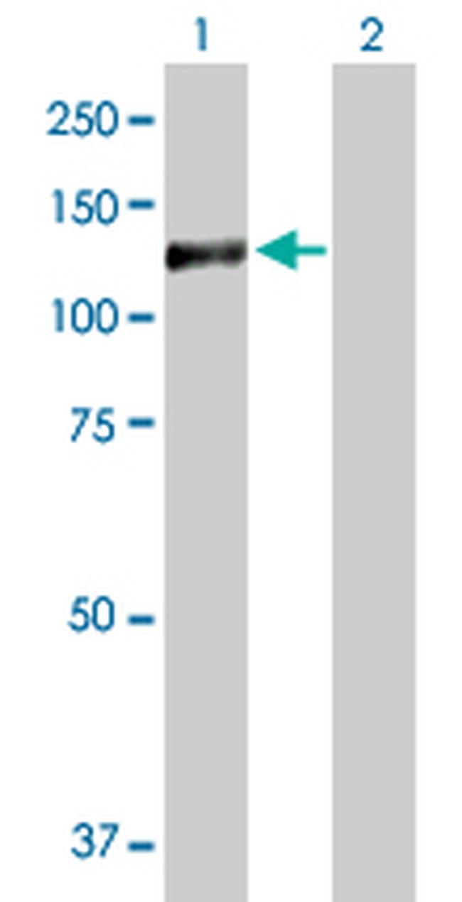 GTF3C2 Antibody in Western Blot (WB)