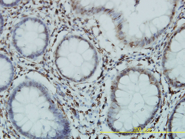 GTF3C2 Antibody in Immunohistochemistry (Paraffin) (IHC (P))