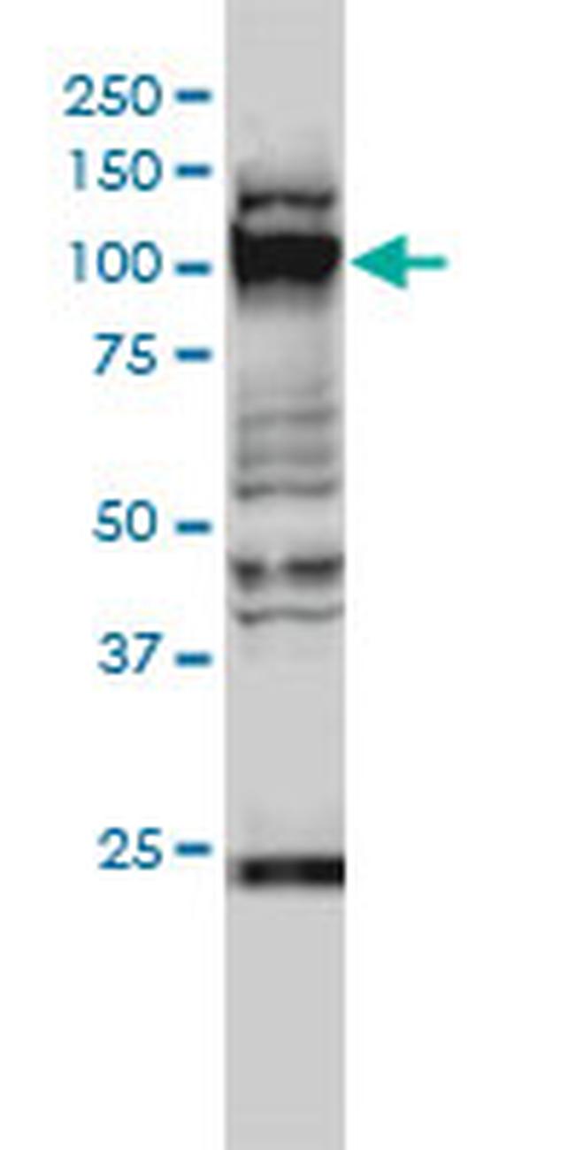 GTF3C2 Antibody in Western Blot (WB)