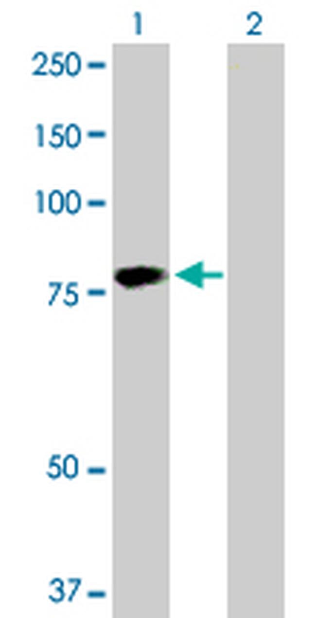 HABP2 Antibody in Western Blot (WB)