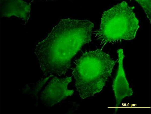 HCLS1 Antibody in Immunocytochemistry (ICC/IF)