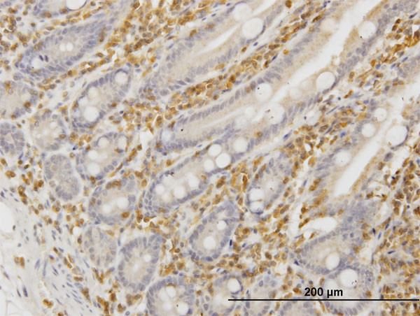 HCLS1 Antibody in Immunohistochemistry (Paraffin) (IHC (P))