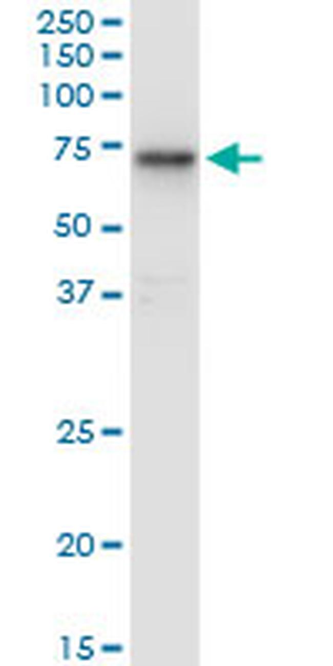 HEXA Antibody in Western Blot (WB)