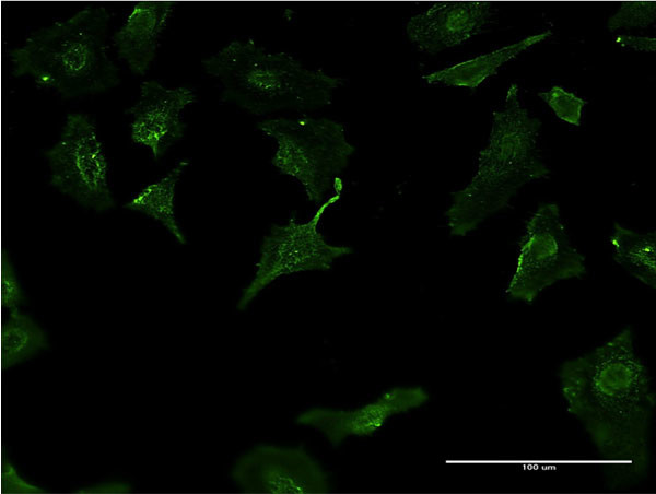 HLA-DMB Antibody in Immunocytochemistry (ICC/IF)