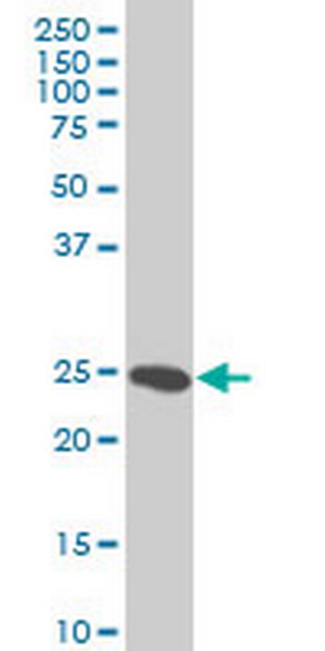 HMGB2 Antibody in Western Blot (WB)