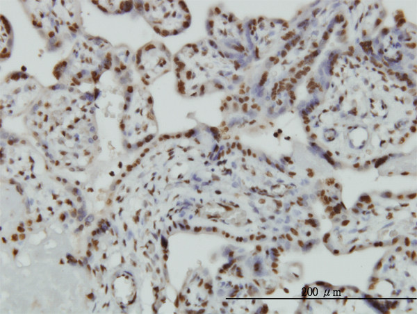 HMGB2 Antibody in Immunohistochemistry (Paraffin) (IHC (P))