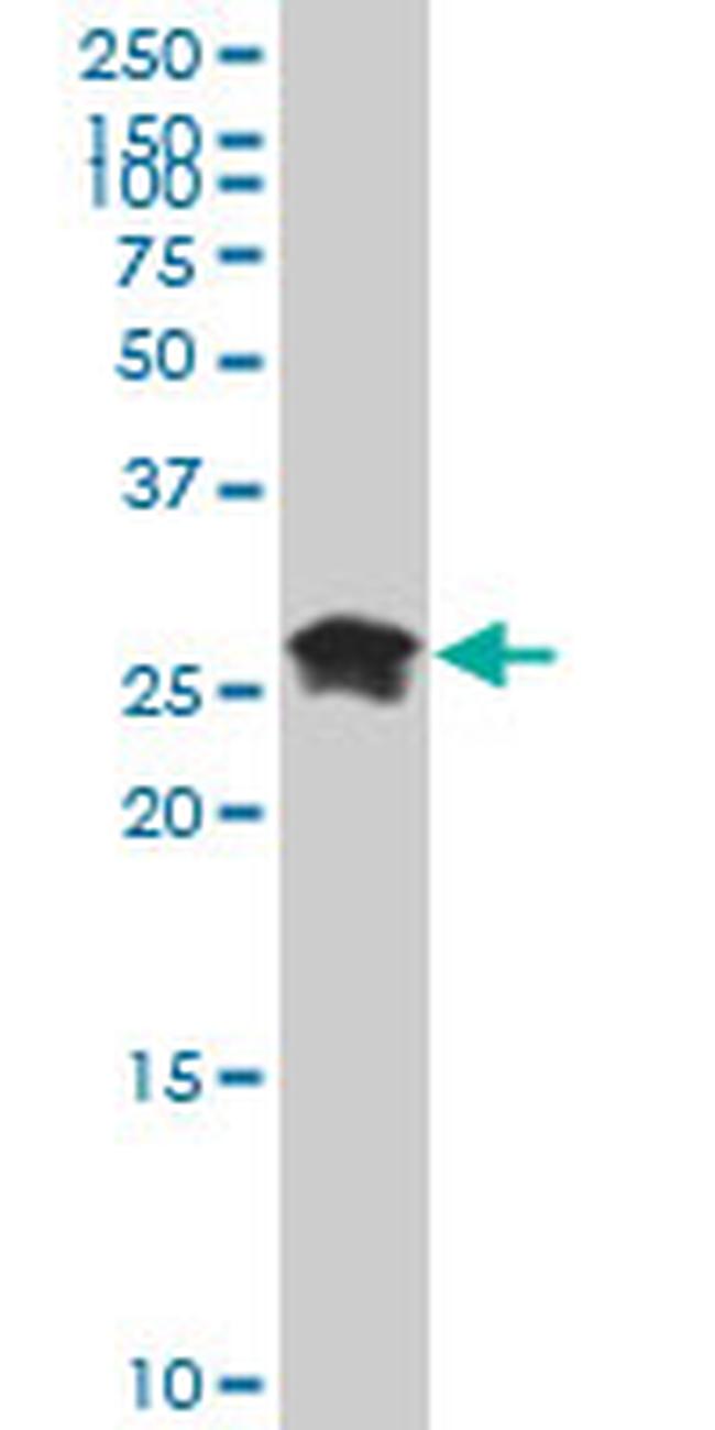 HMGB2 Antibody in Western Blot (WB)