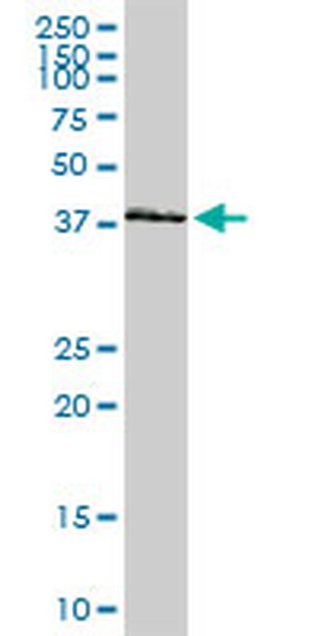 HOXA11 Antibody in Western Blot (WB)