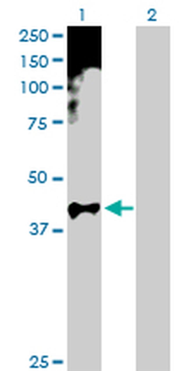 HOXA11 Antibody in Western Blot (WB)