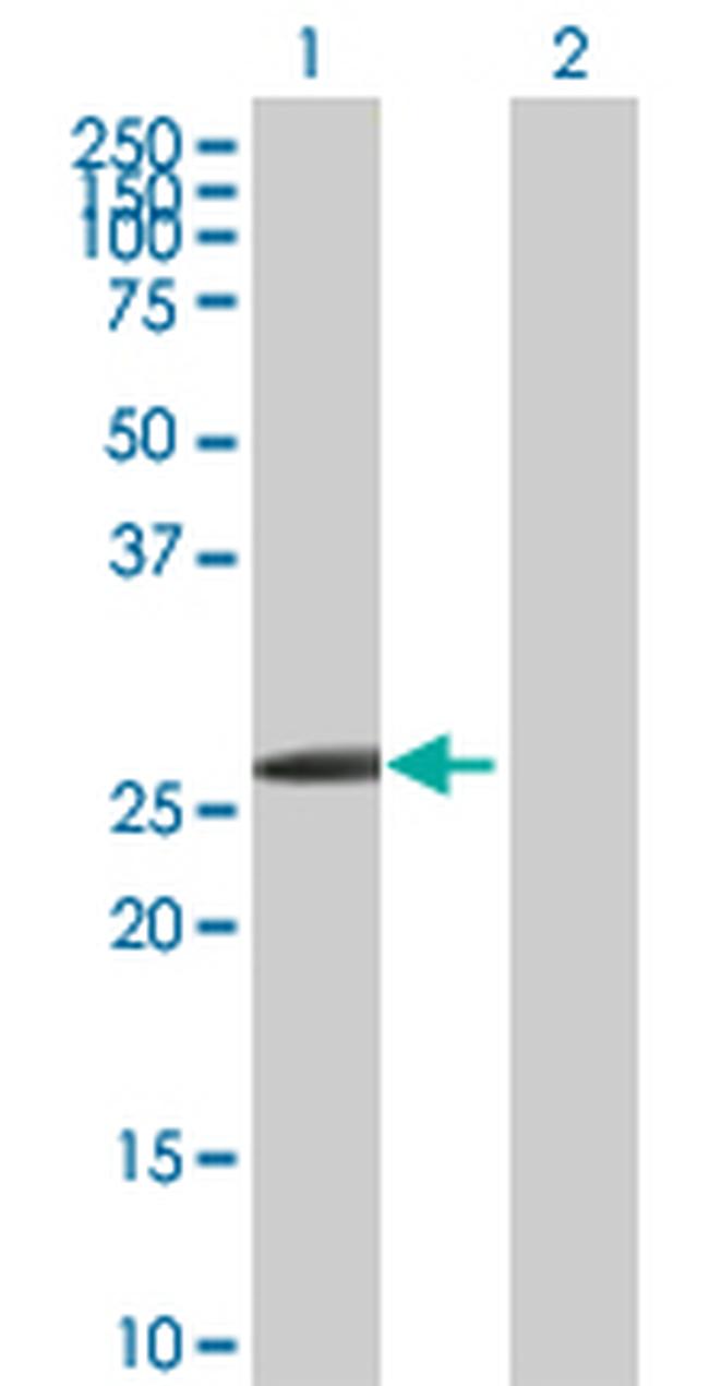 HOXB1 Antibody in Western Blot (WB)