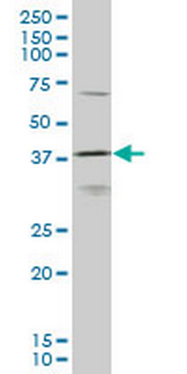 HOXD11 Antibody in Western Blot (WB)