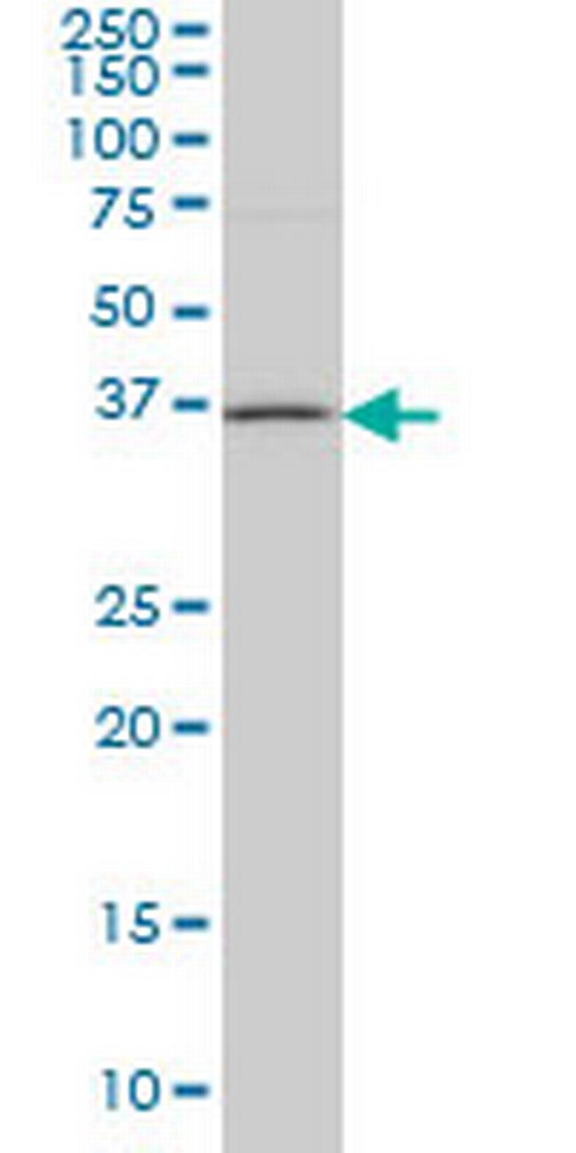 HSD17B1 Antibody in Western Blot (WB)
