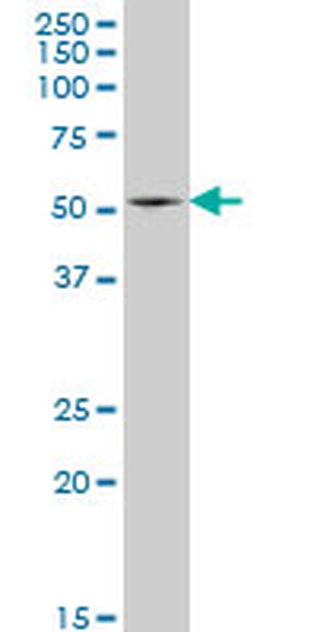 HSF4 Antibody in Western Blot (WB)