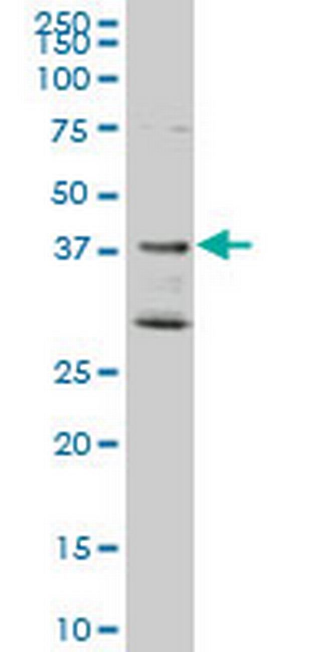 DNAJB2 Antibody in Western Blot (WB)