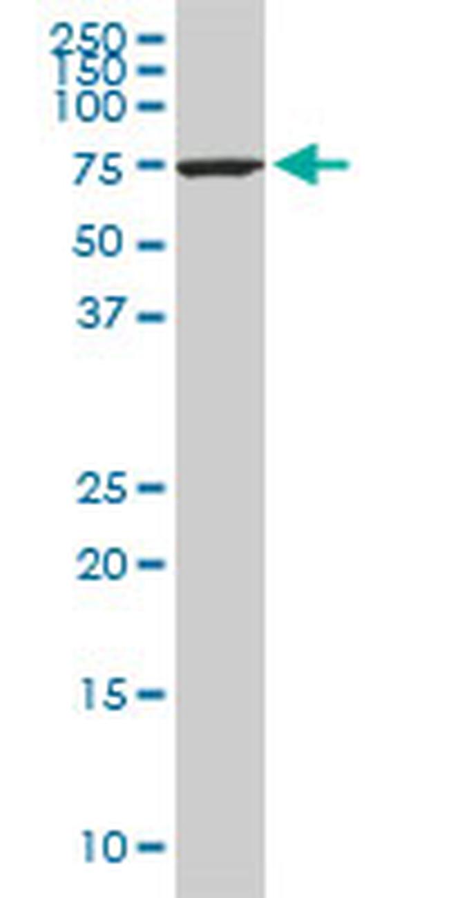 HSPA1L Antibody in Western Blot (WB)