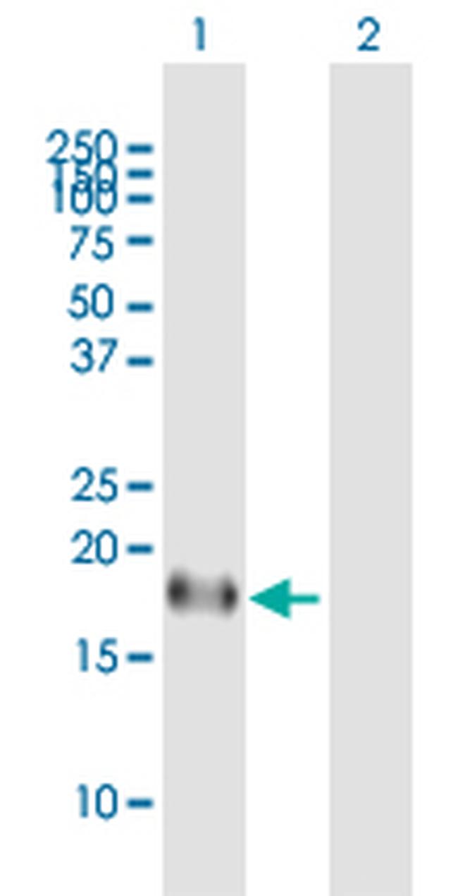 ID4 Antibody in Western Blot (WB)