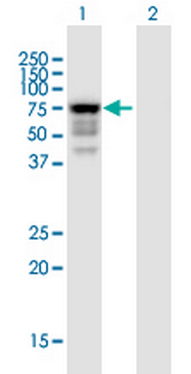 IDS Antibody in Western Blot (WB)